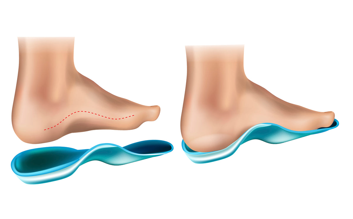 Arch Support in Shoes Good or Bad? Moccasins Canada
